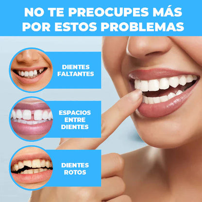 Carillas Dentales - Solución rapida para una sonrisa perfecta